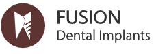 Fusion Dental Implants